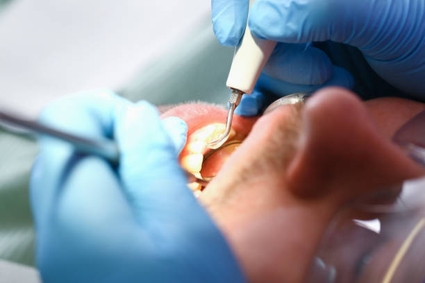 Best Emergency Treatment for Dental Infections or Abscesses in Flandreau, SD